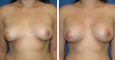 Before & After Photos